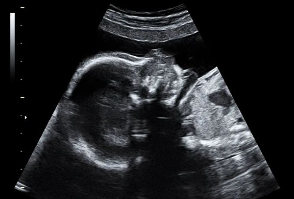 41岁，外院试管三次没成？她说：换个思路，我的人生彩蛋来了！