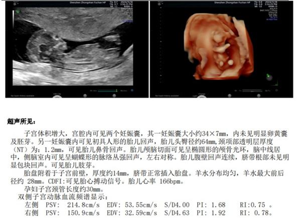 从7年7次失败，到一次成功抱娃，她做对了什么？