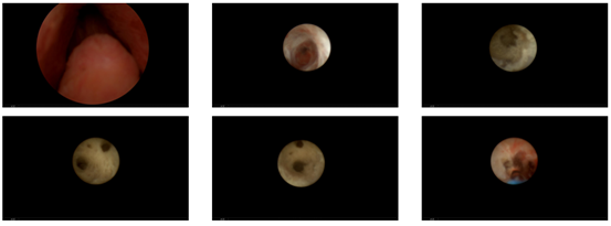 20天，弱精变“超跑”！只因医生做了这件事……（无数夫妻看完重燃希望）