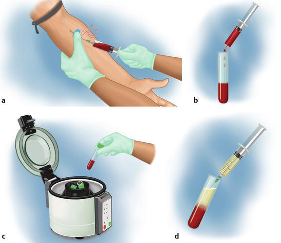 2个月，我的AMH从0.53逆袭到0.81！