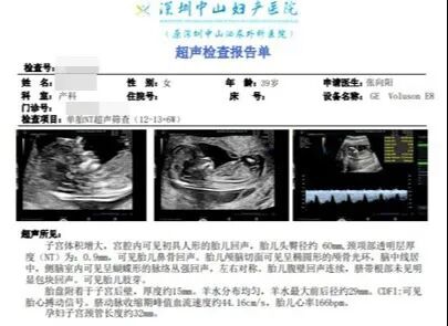 39岁，两次流产之后，她终于等来了宝宝的心跳……