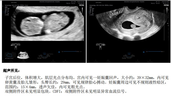 经历4次失败，32岁妈妈用最“狠”的方案迎来奇迹宝宝！