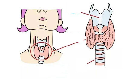 甲状腺生长的位置图片图片