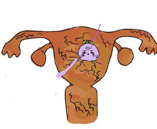 ԹܱС֪ʶŮԵӹĤ̥ӡ