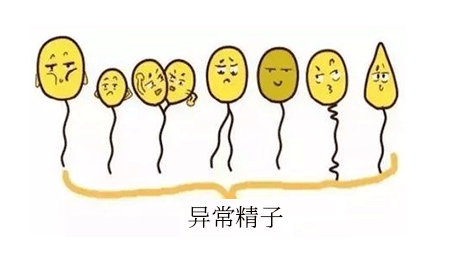 ξ