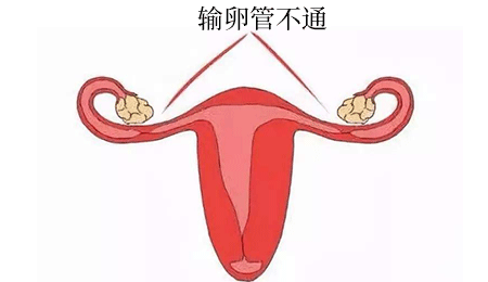 ѹܲͨ