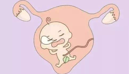 ӹĤ
