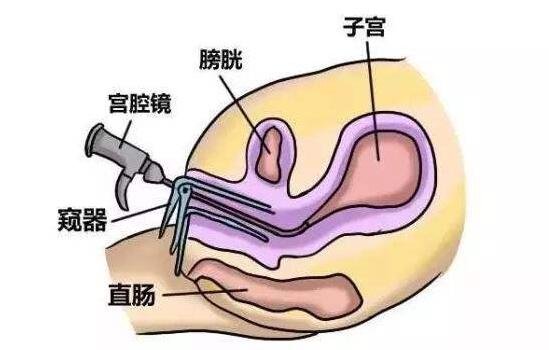 ǻÿԹӤ