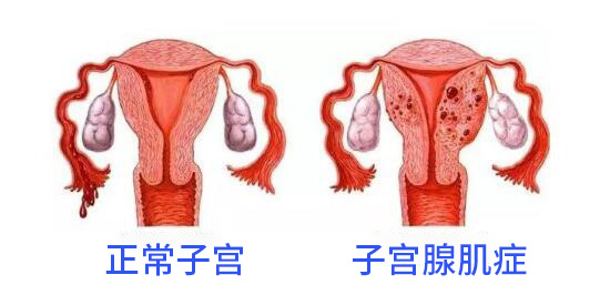 ӹټ֢